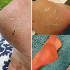 Andew Berfore & After