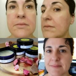 Nourishing Face Balm Before/After burning my face with Apple Cider Vinegar