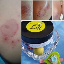 Renew Balm: Cuts, Rashes Bites