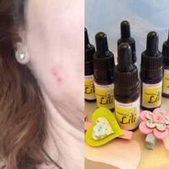 Just Soothing Face Infection