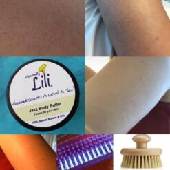 Keratosis Pilars Before/After